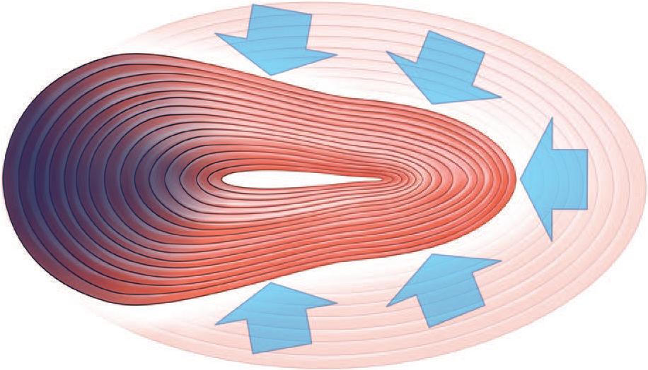 Fig. 17.3, Neurotoxin within the sphincter leads to a blowout in that part of the sphincter. Note that this is present in three dimensions, so as well as preventing the sphincter from closing, it also allows the sphincter to bulge anteriorly or downward (because of the effect of gravity or infraorbital pressure).