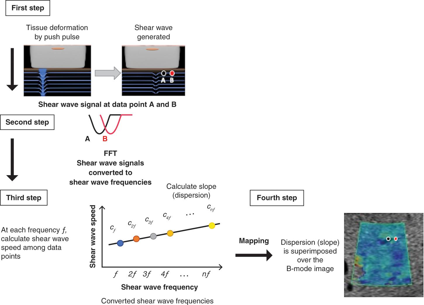 Fig. 12.2, Schematic diagram of shear wave dispersion (SWD) map processing. SWD processing involves four steps. First, the displacement induced by the shear waves is obtained using a technique based on color-Doppler scanning. Second, the displacement at each location is converted from the time domain to the frequency domain by fast Fourier transform (FFT) to estimate the phase changes of the shear waves at several frequencies (f) . Third, shear wave speed (SWS) is calculated using the phase-difference method. Fourth, the gradient of SWS is calculated based on the distribution of SWS versus frequency. The gradient value is then superimposed on the measurement locations to create a dispersion map.