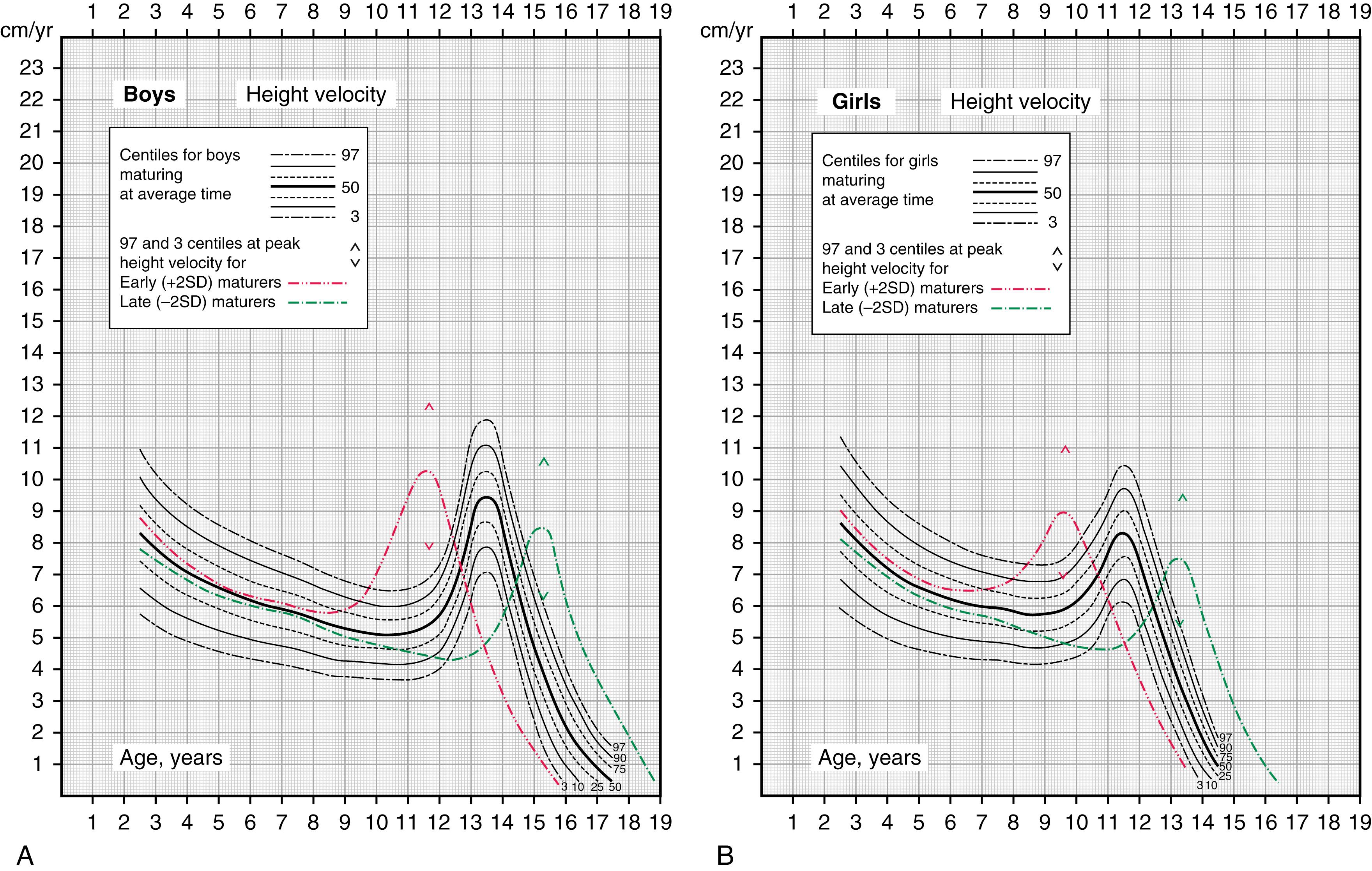 Fig. 56.3, A, Height velocity for American males. Lines with early velocity refer to the 50th centile for boys 2 standard deviations (SD) early in growth tempo; lines with late or gradual velocity refer to the 50th centile for boys 2 SD late in growth tempo. ^ and v, 97th and 3rd centiles for peak velocities of early and late maturers, respectively. B, Height velocity for American females. Lines with early velocity refer to the 50th centile for girls 2 SD early in growth tempo; lines with late or gradual velocity refer to the 50th centile for girls 2 SD late in growth tempo. ^ and v, 97th and 3rd centiles for peak velocities of early and late maturers, respectively.