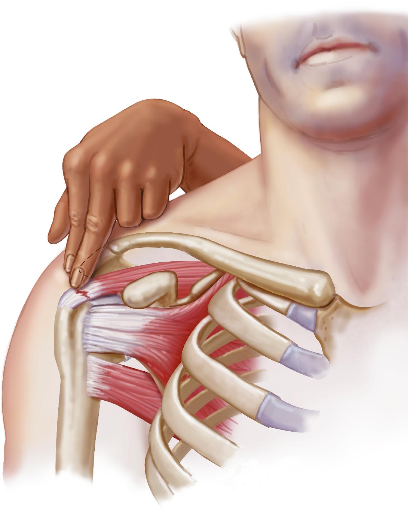 Figure 9-15, Palpation of subacromial space.