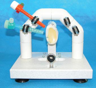 FIGURE 1.8, Glenohumeral joint reconstruction model.