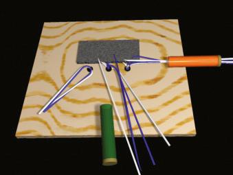 FIGURE 1.82, Withdraw the suture strand that is through the felt, and pull it out the anterolateral stab wound.