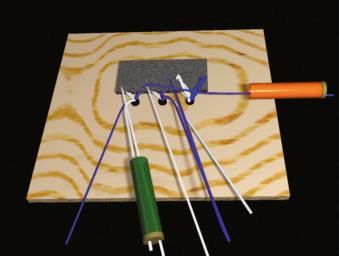 FIGURE 1.92, Retrieve the posterior anchor white strand from the anterior cannula, and withdraw it through the lateral cannula.