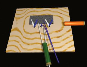 FIGURE 1.96, Retrieve both middle anchor white sutures, and withdraw them through the lateral cannula.