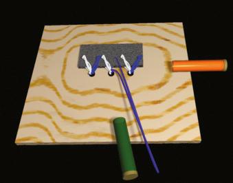 FIGURE 1.97, Tie the middle anchor white sutures.