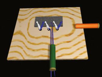 FIGURE 1.98, Retrieve both middle anchor blue sutures, and withdraw them through the lateral cannula.