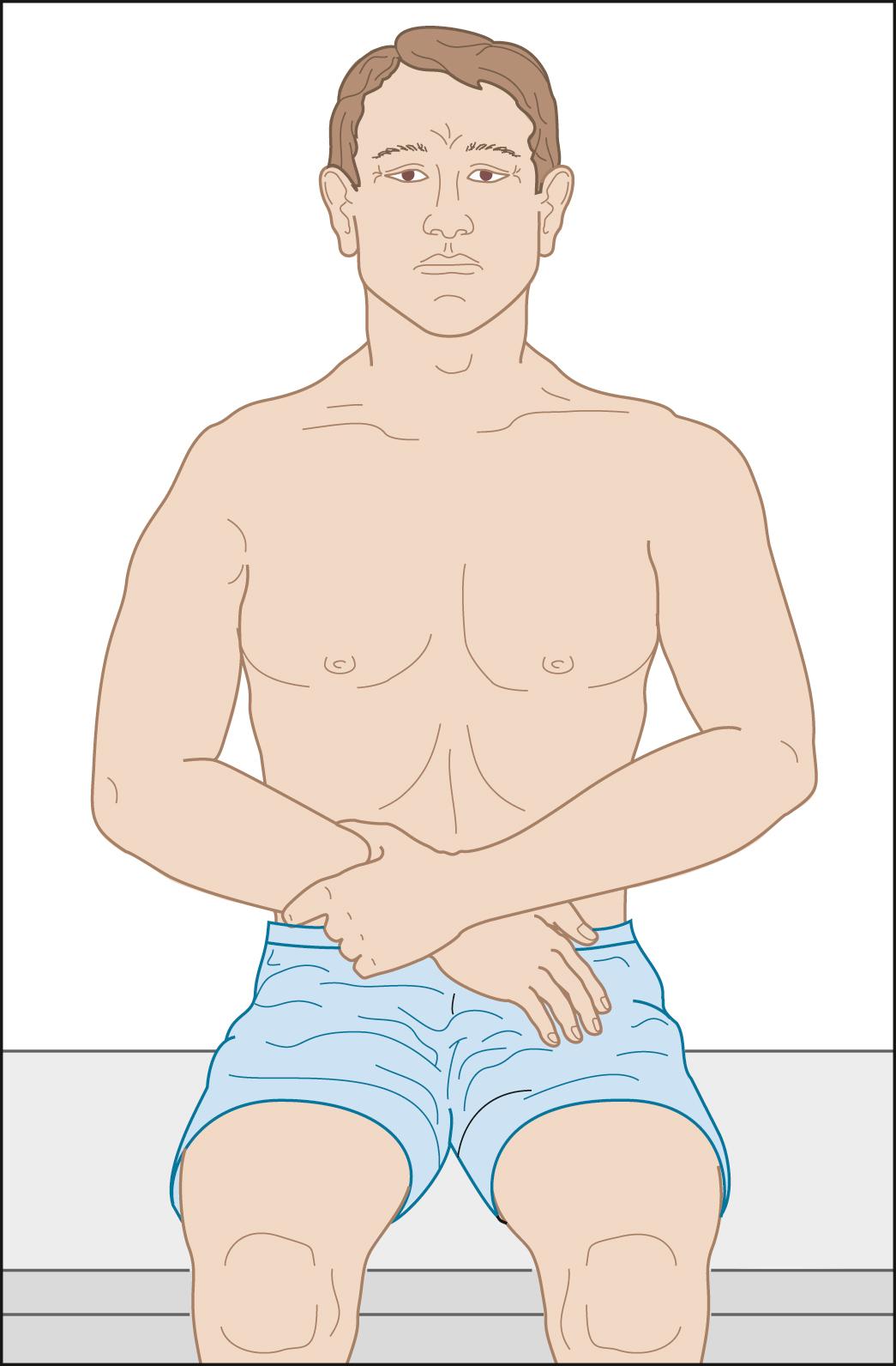 Fig. 128.1, Shoulder dislocation with loss of the normal deltoid bulge.