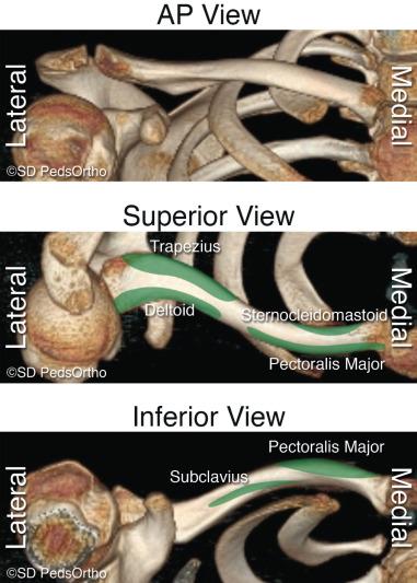 Fig. 133.1, Muscle attachments to the clavicle. AP, Anteroposterior.