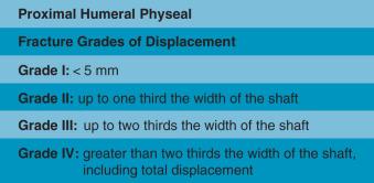 Fig. 133.14, Proximal humeral physeal fracture grades of displacement.