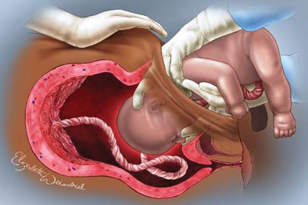 FIGURE 8, Selected obstetrical emergencies image from revised ASSET manual and ASSET plus course.