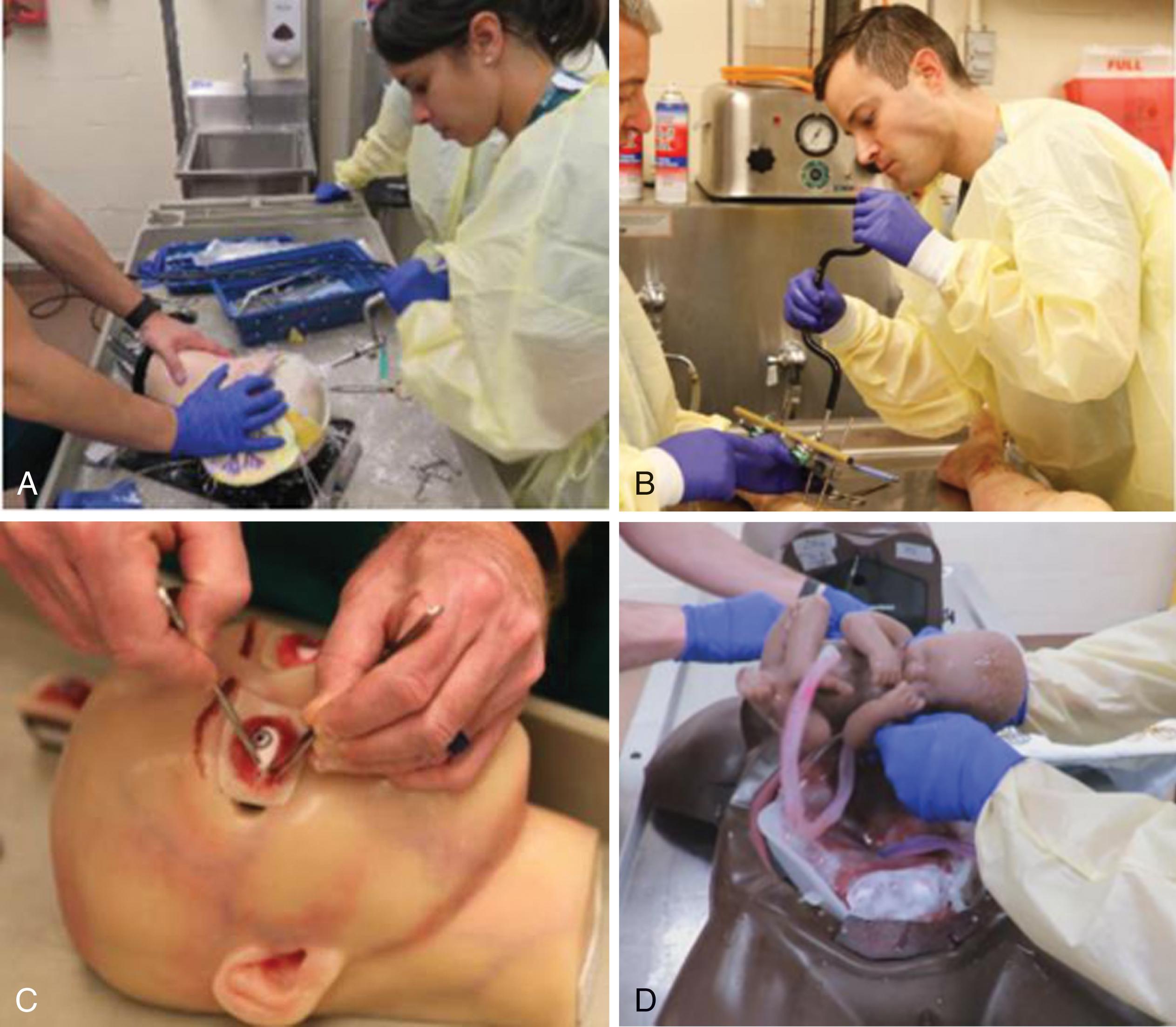 FIGURE 9, Advanced part task simulators used to teach craniotomy (A) , external fixation of an extremity (B) , lateral canthotomy and cantholysis (C) , and emergency cesarean section (D) .