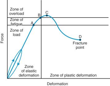 e-Figure 142.3, Graphic relation of bony deformation (bowing) and force (longitudinal compression).