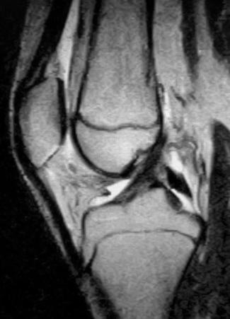 Fig. 19.1, Sagittal magnetic resonance imaging of pediatric knee.