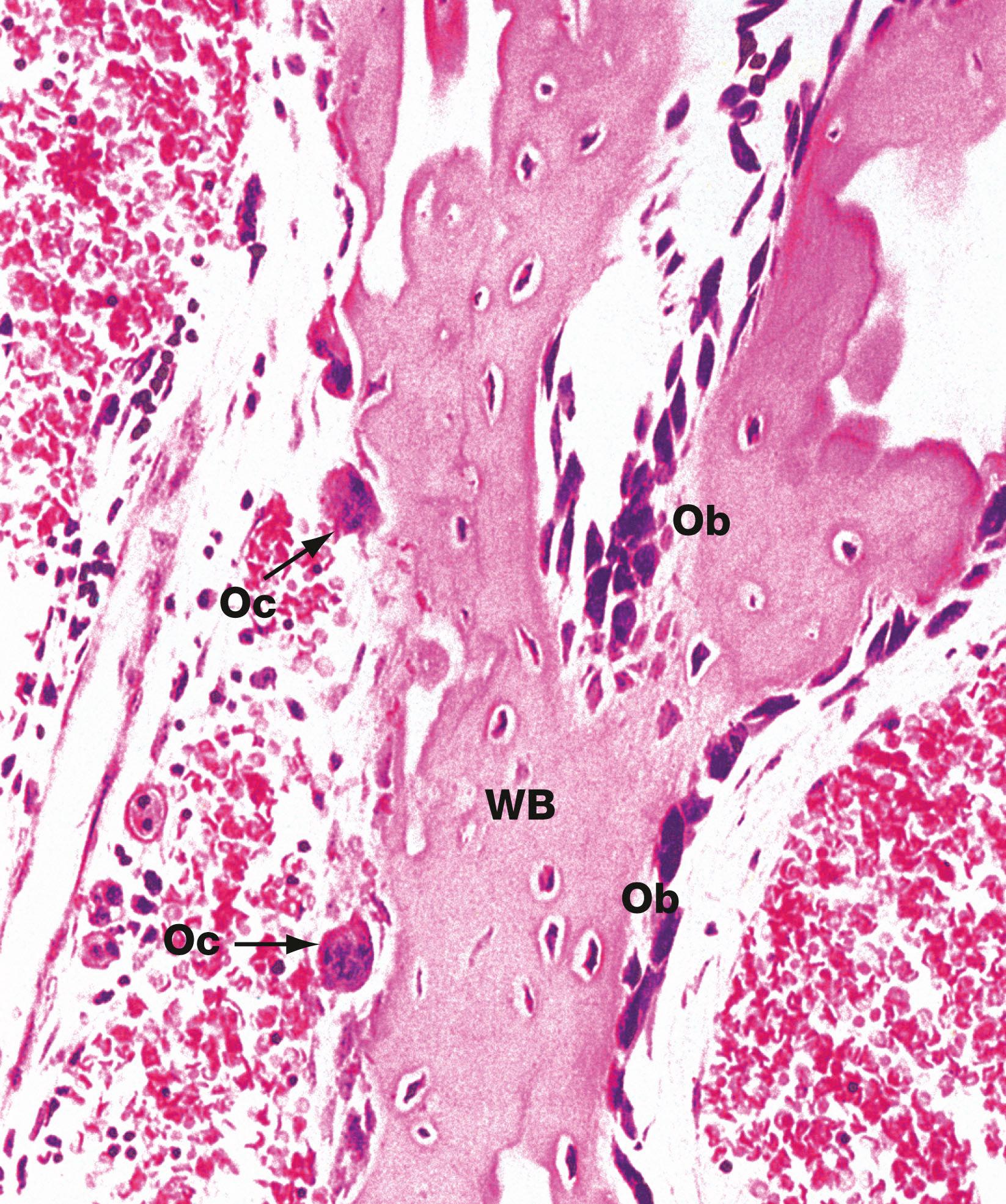 Fig. 10.23, Bone remodelling and repair