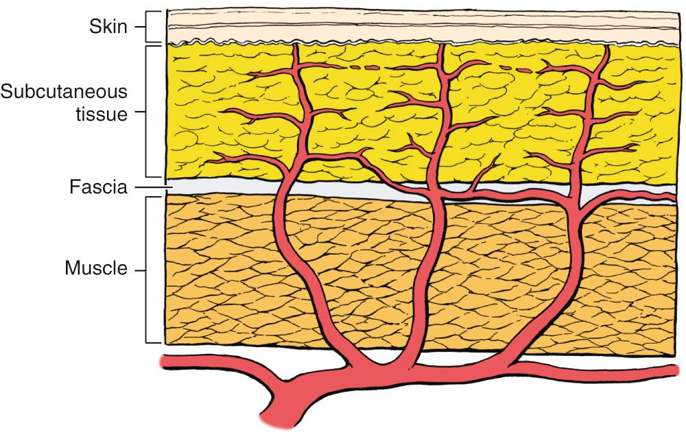 Fig. 77.4, Architecture of arterial supply to the skin.