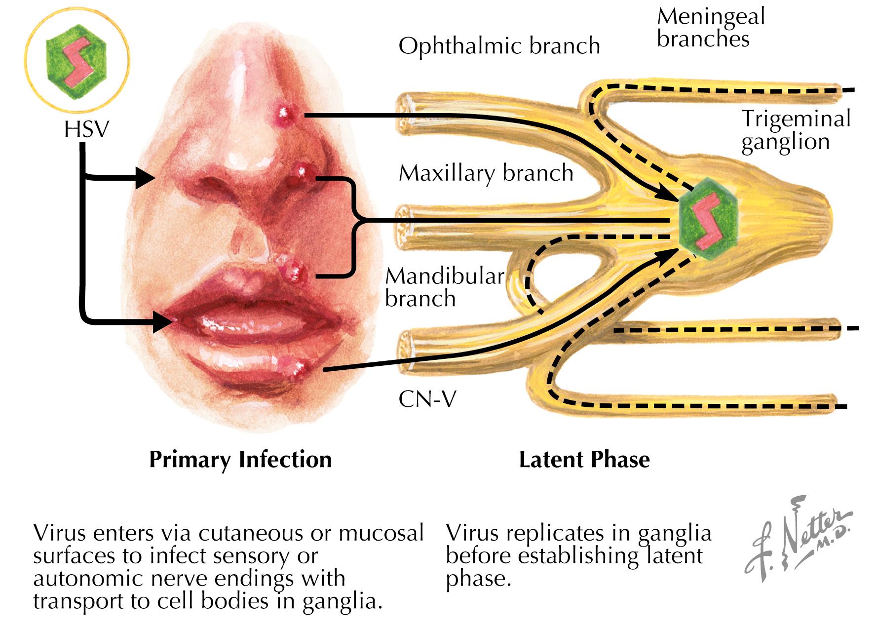 Figure 40.1, Herpes simplex.