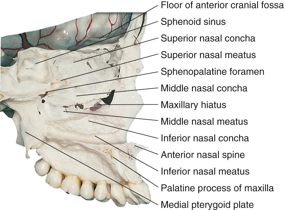 Figure 6.16, Sagittal section of the skull through the left nasal cavity.