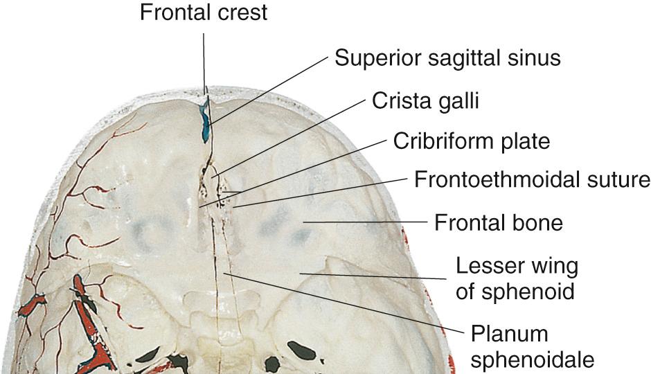 Figure 6.17, Intracranial view of the floor of the anterior cranial fossa.