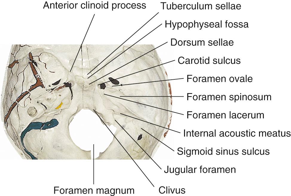 Figure 6.18, Intracranial view of the middle fossa.