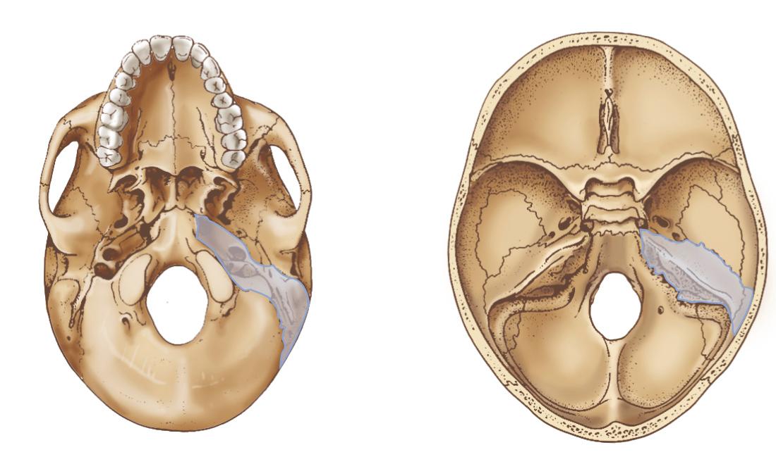 Figure 6.25, Temporal bone region.