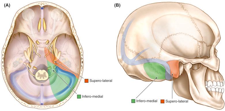 Figure 10.2, Surgical corridors to the posterior cranial fossa; (A) axial view and (B) right posterolateral view.