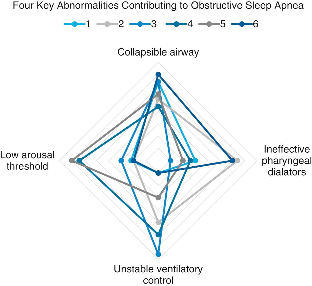 Fig. 15.1, Schematic demonstrating that four main physiologic impairments contribute to the development of obstructive sleep apnea. While all patients will have a narrowed and collapsible airway, ineffective upper-airway dilator muscles, a low respiratory arousal threshold, and unstable ventilator control will contribute in variable degrees amongst different patients.