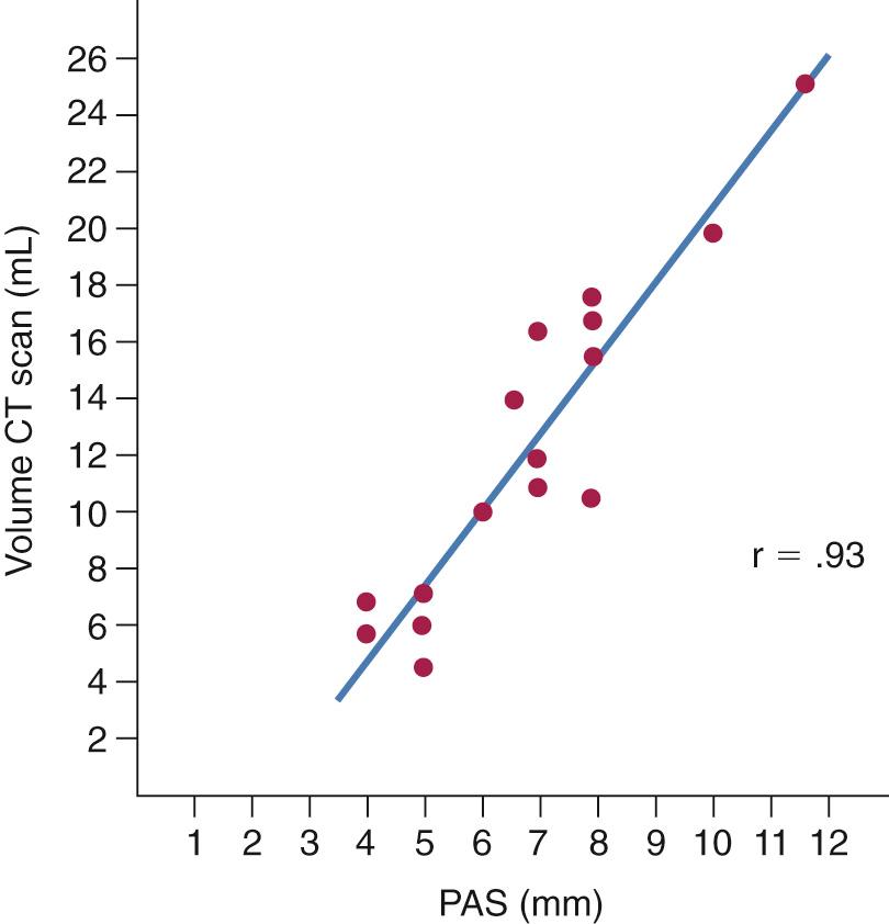 Fig. 15.8, Comparison of the hypopharyngeal airway volume by computed tomography (CT) scan to posterior airway space (PAS) , measured on cephalometric radiographs.