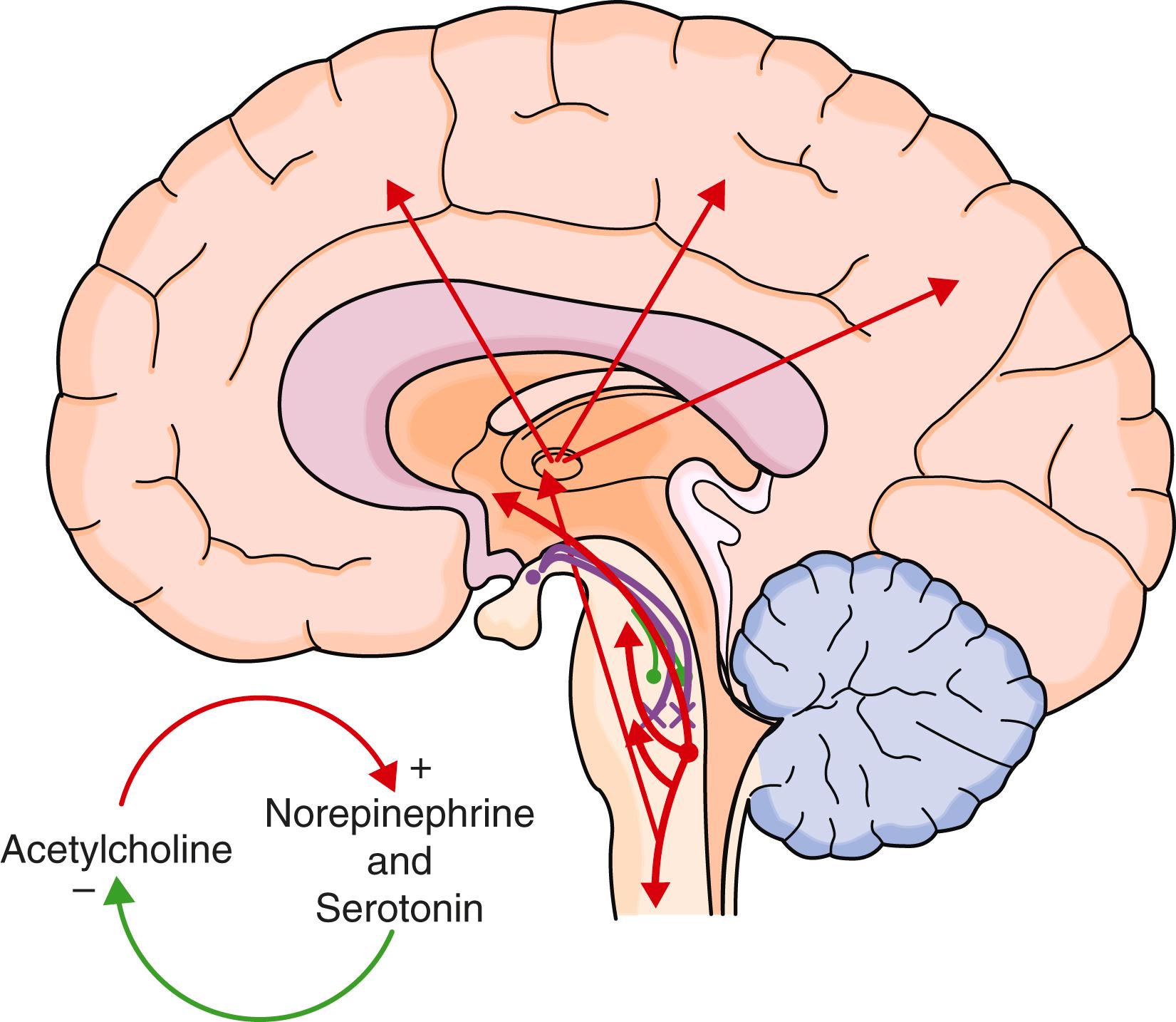 E-FIGURE 374-3, Rapid eye movement sleep (REM) sleep is activated from the subcoeruleus nucleus, which uses acetylcholine ( red arrows ), and further deactivation ( purple arrows ) of norepinephrine- and serotonin-producing neurons ( green ).