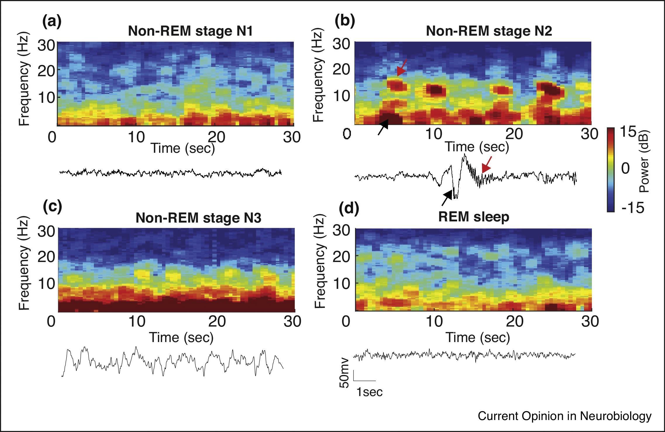 Fig. 48.2, Distinct EEG patterns during sleep and general anesthesia.