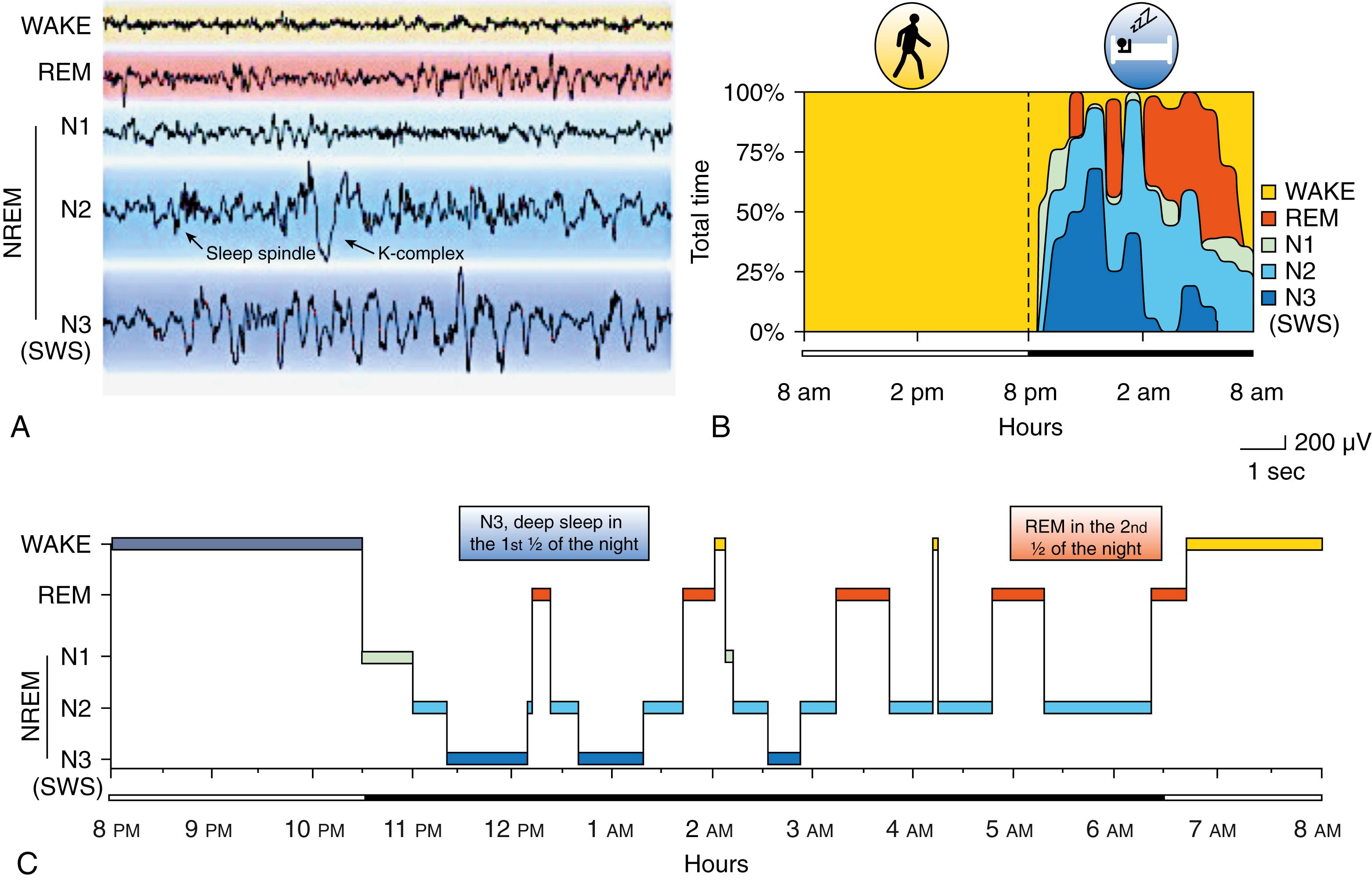 Fig. 101.1, Sleep Hypnogram.