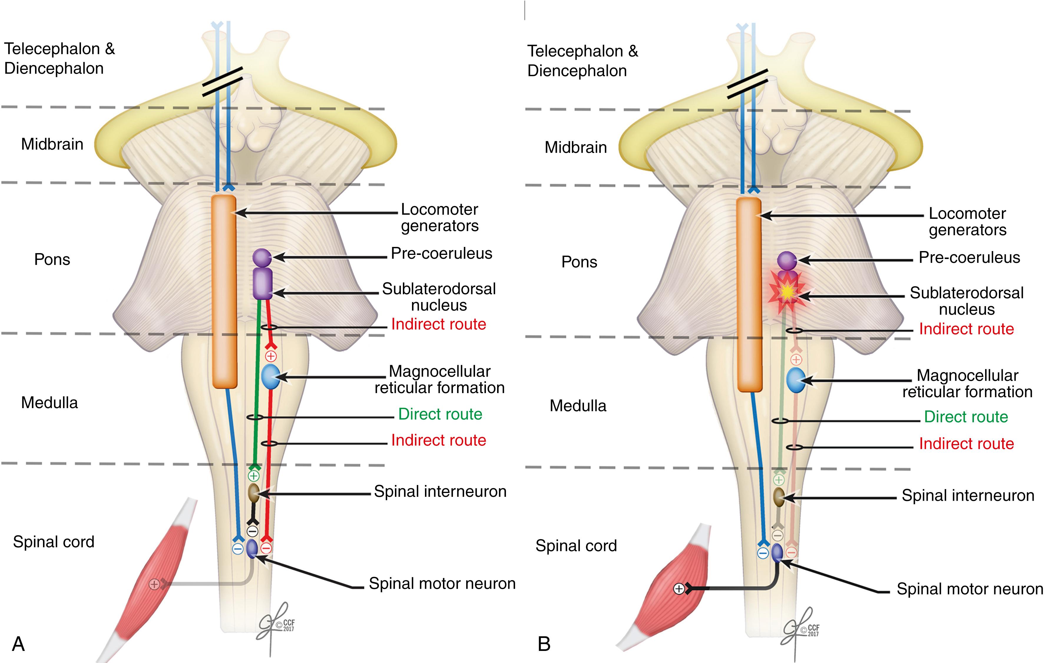 Fig. 101.19, Neurophysiology and Neuropathology of Rapid Eye Movement (REM) Sleep Motor Control.