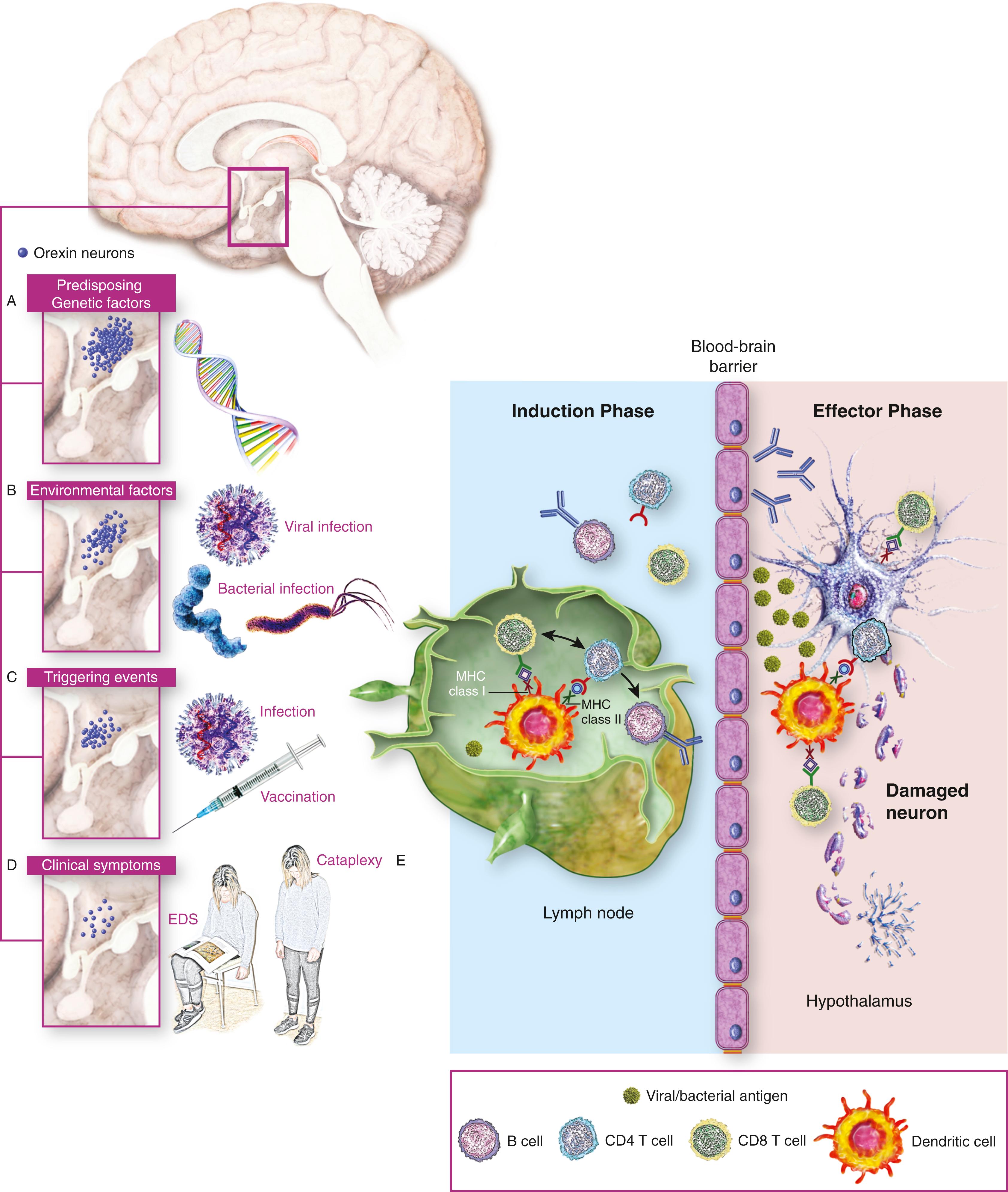 Fig. 101.37, Plausible Disease Mechanism in Narcolepsy.