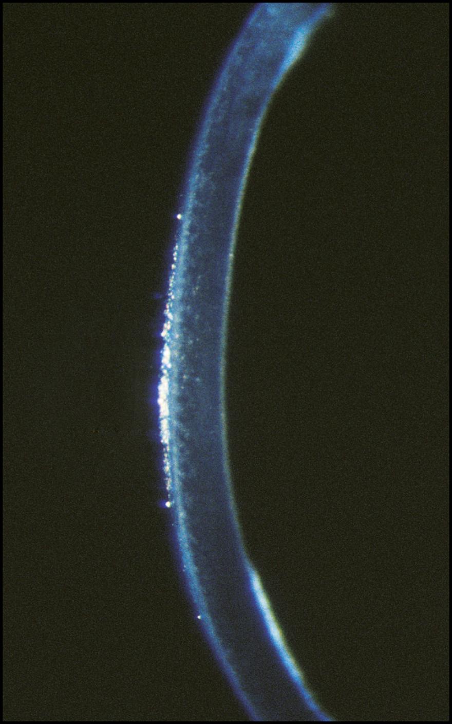 Fig. 7.13, The fragmented reflection from the corneal surface indicates an inadequate tear film, an uneven epithelial surface, or both.