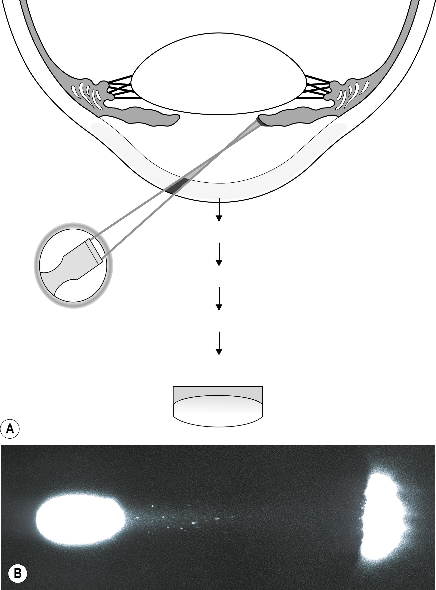 Fig. 7.24, ( A ) and ( B ) Pinpoint illumination of cells and flare, recorded with the ISO setting at 1000.