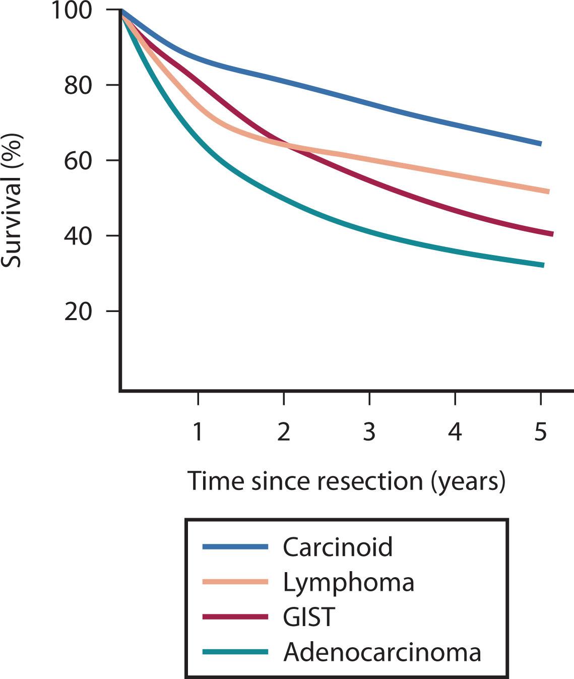 Figure 17.1, Five-year survival rates by histologic subtype for patients who underwent resection (Data from National Cancer Data Base, 1985–2000). GIST , Gastrointestinal stromal tumor.