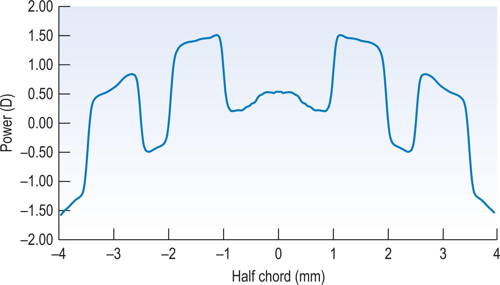 Fig. 7.8, Power profile of a bifocal contact lens with concentric distance and add rings.
