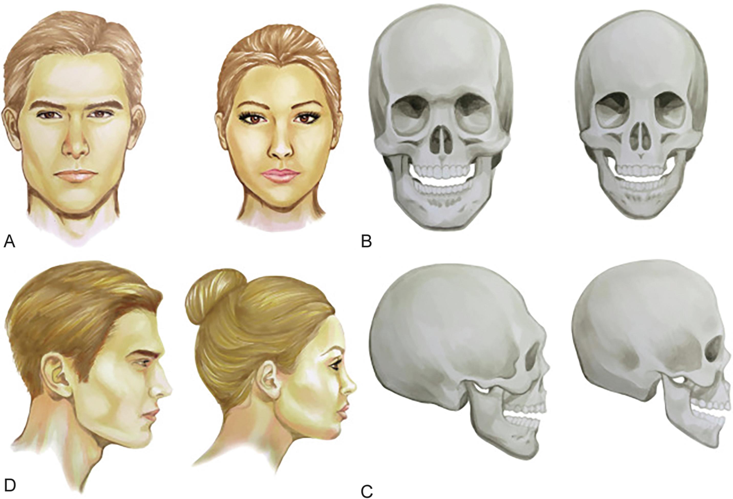 Fig. 24.3, Differences in male and female faces. (A) Frontal view. (B) Frontal skeletal view. (C) Lateral view. (D) Lateral skeletal view.