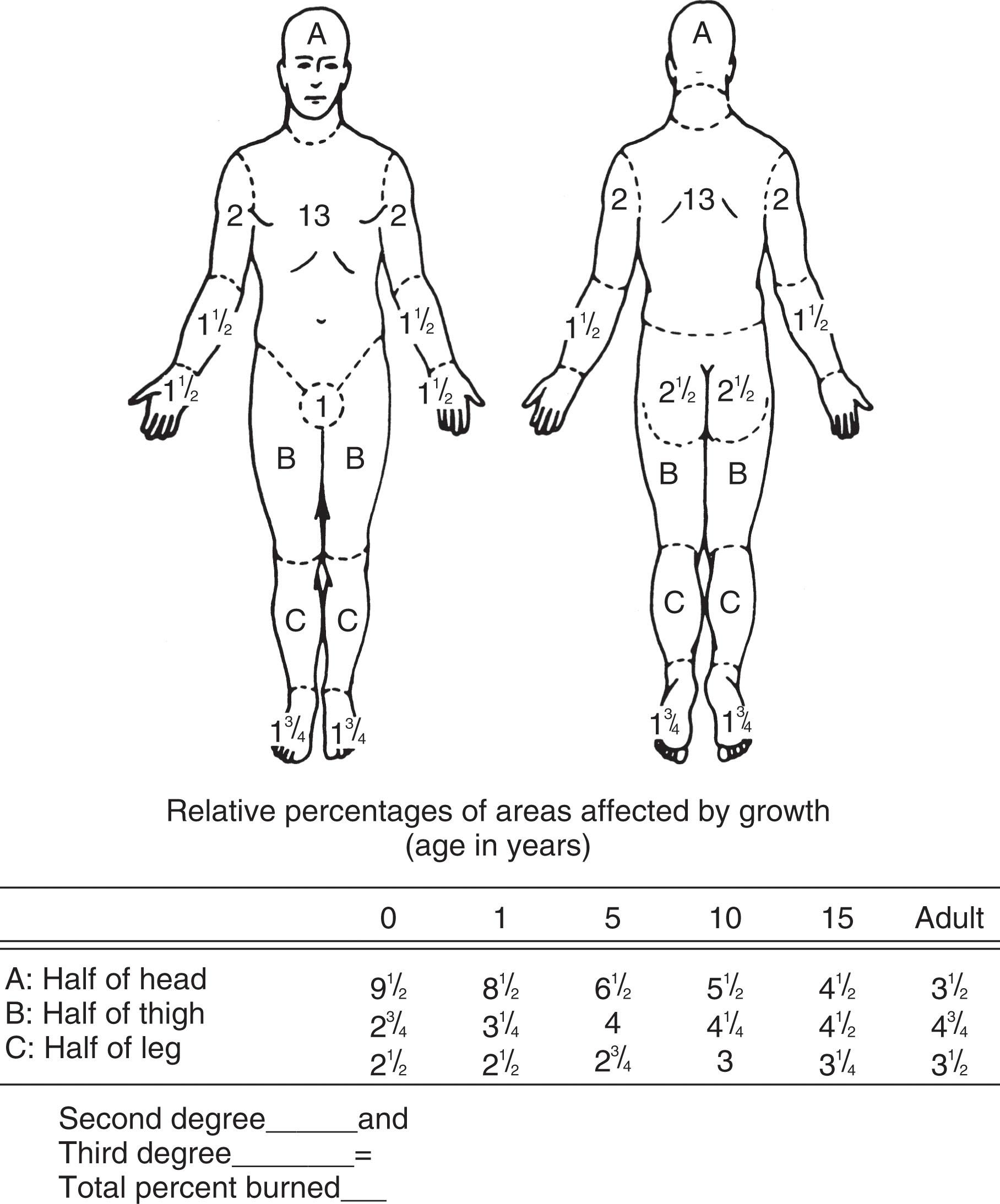 Fig. 15-1, Lund and Browder chart showing that each foot accounts for 3.5% total body surface area in the context of estimation of burn involvement.