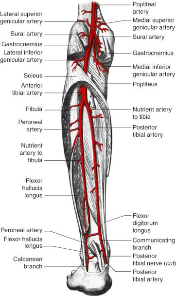 Figure 51.4, Arterial anatomy of the region.