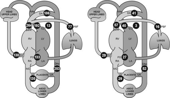 FIG 13-2, Distribution of the normal human fetal circulation measured by phase-contrast MRI in 40 late-gestation fetuses expressed as mean flows (mL/minute per kg) (numbers in black circles, left ) and converted to modeled mean percentages of the combined ventricular output (numbers in black circles, right ). FO flow calculated as the difference between left ventricular output and PBF. AAo, ascending aorta; ABDO, abdomen; DA, ductus arteriosus; Dao, descending aorta; FO, foramen ovale; IVC, inferior vena cava; LA, left atrium; LV, left ventricle; MPA, main pulmonary artery; PBF, pulmonary blood flow; RA, right atrium; RV, right ventricle; SVC, superior vena cava; UA, umbilical artery; UV, umbilical vein.