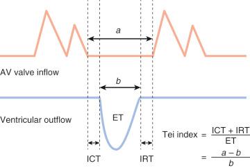 FIG 13-34, Calculation of the myocardial performance index (MPI, or Tei index). AV, atrioventricular; ET, ejection time; ICT, isovolumetric contraction time; IRT, isovolumetric relaxation time.