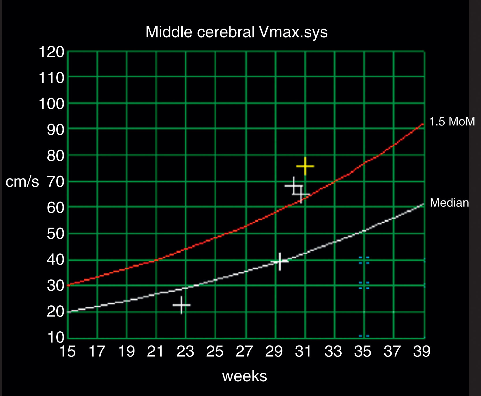 Fig. 54.9, Middle cerebral blood flow velocity for gestational age.