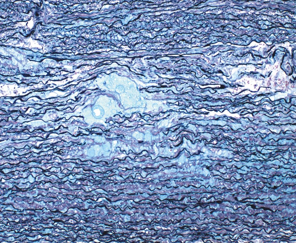 Figure 1.1, Elastin/Alcian blue stain.