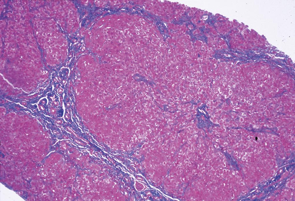 Figure 1.2, Masson trichrome stain.