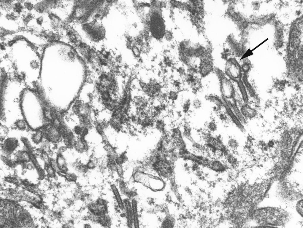 Figure 1.9, Electron microscopy.