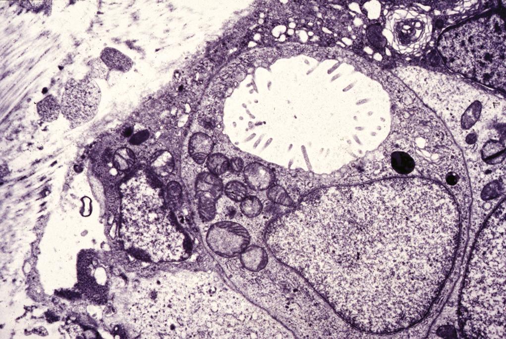 Figure 1.10, Electron microscopy.