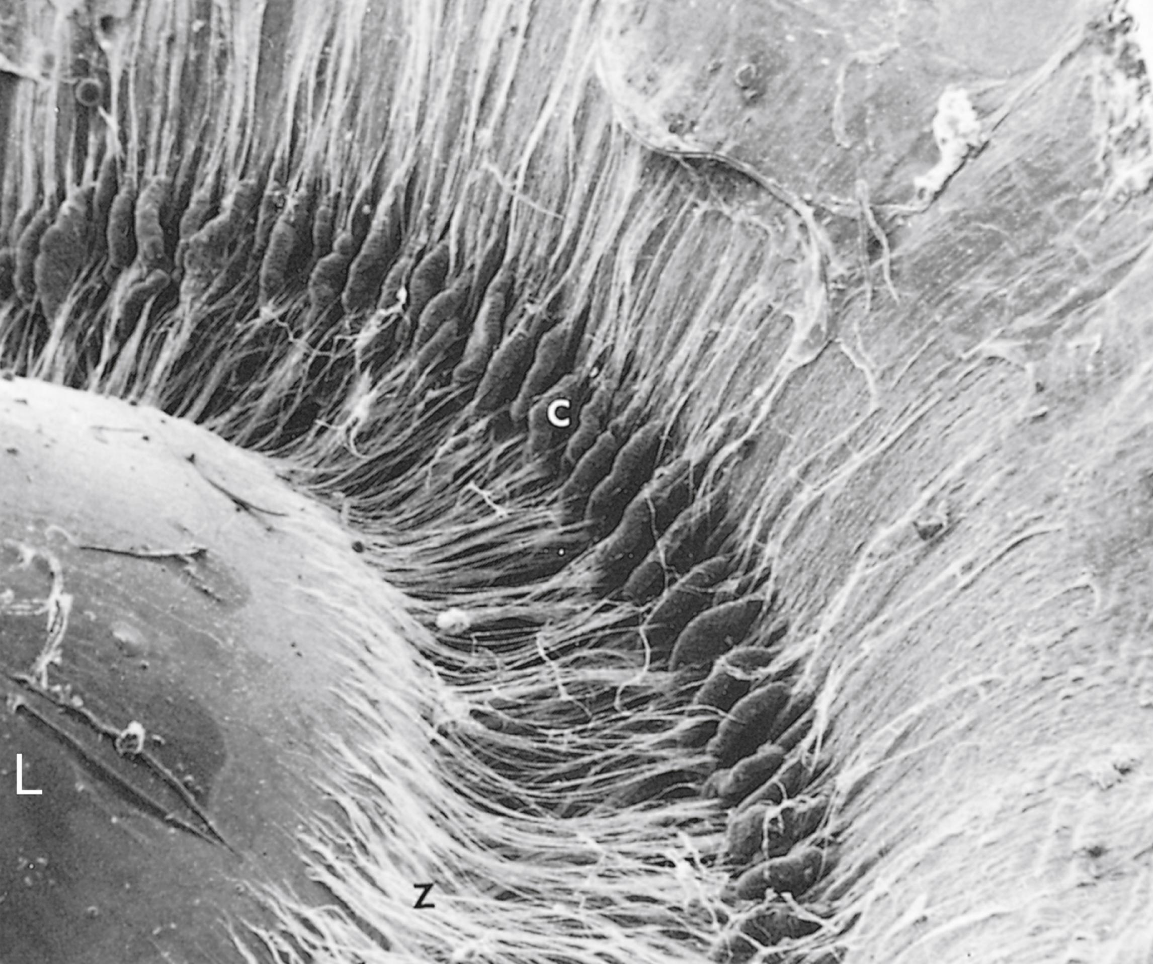 Fig. 22.12, Scanning electron micrograph of the posterior surface of the lens (×28). C, Ciliary body; L, lens; Z, zonula fibers. (From Leeson TS, Leeson CR, Paparo AA. Text/Atlas of Histology . Philadelphia: WB Saunders; 1988.)