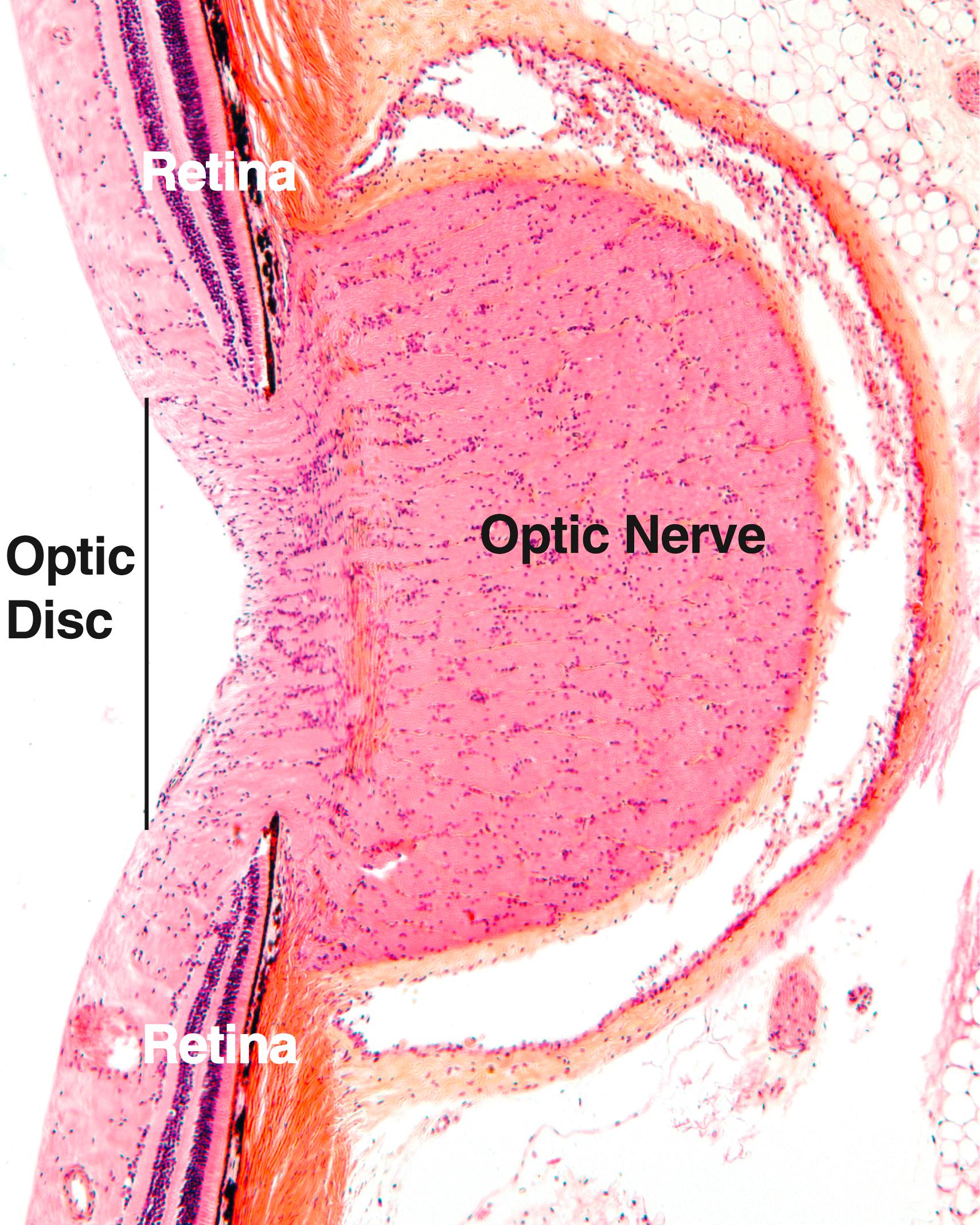 Fig. 22.14, This very-low-magnification photomicrograph of the optic disc demonstrates that the retinal layers stop at the periphery of the optic disc, the blind spot of the retina. The axons of the various nerve cells of the retina are gathered to form the optic nerve at the optic disc. (×56)