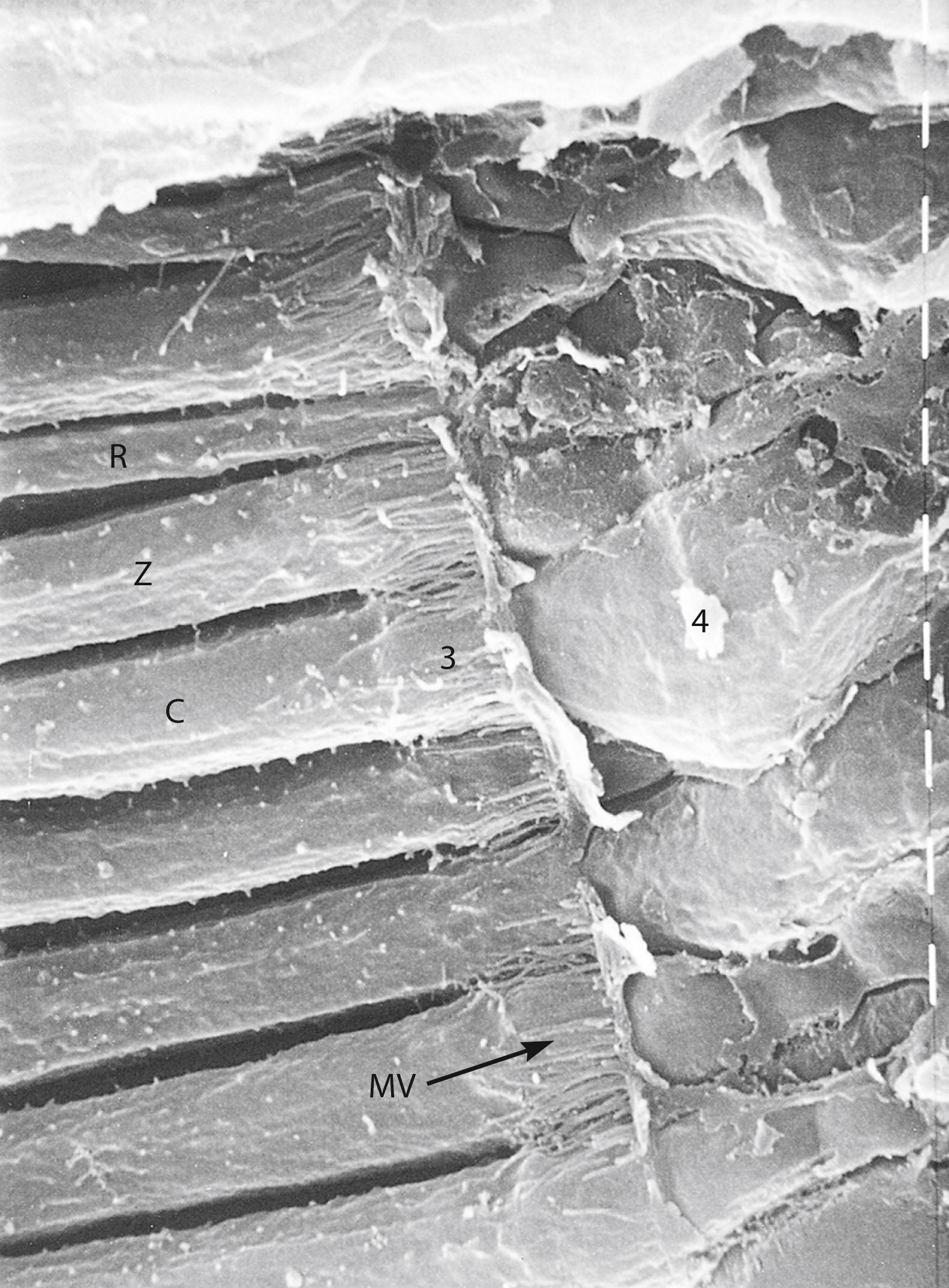 Fig. 22.20, Scanning electron micrograph of the retina in a monkey in a displaying cone (C) and a few rods (R) (×5800). 3, External limiting membrane; 4, outer nuclear layer; MV, microvilli belonging to the Müller cells; Z, inner segments.