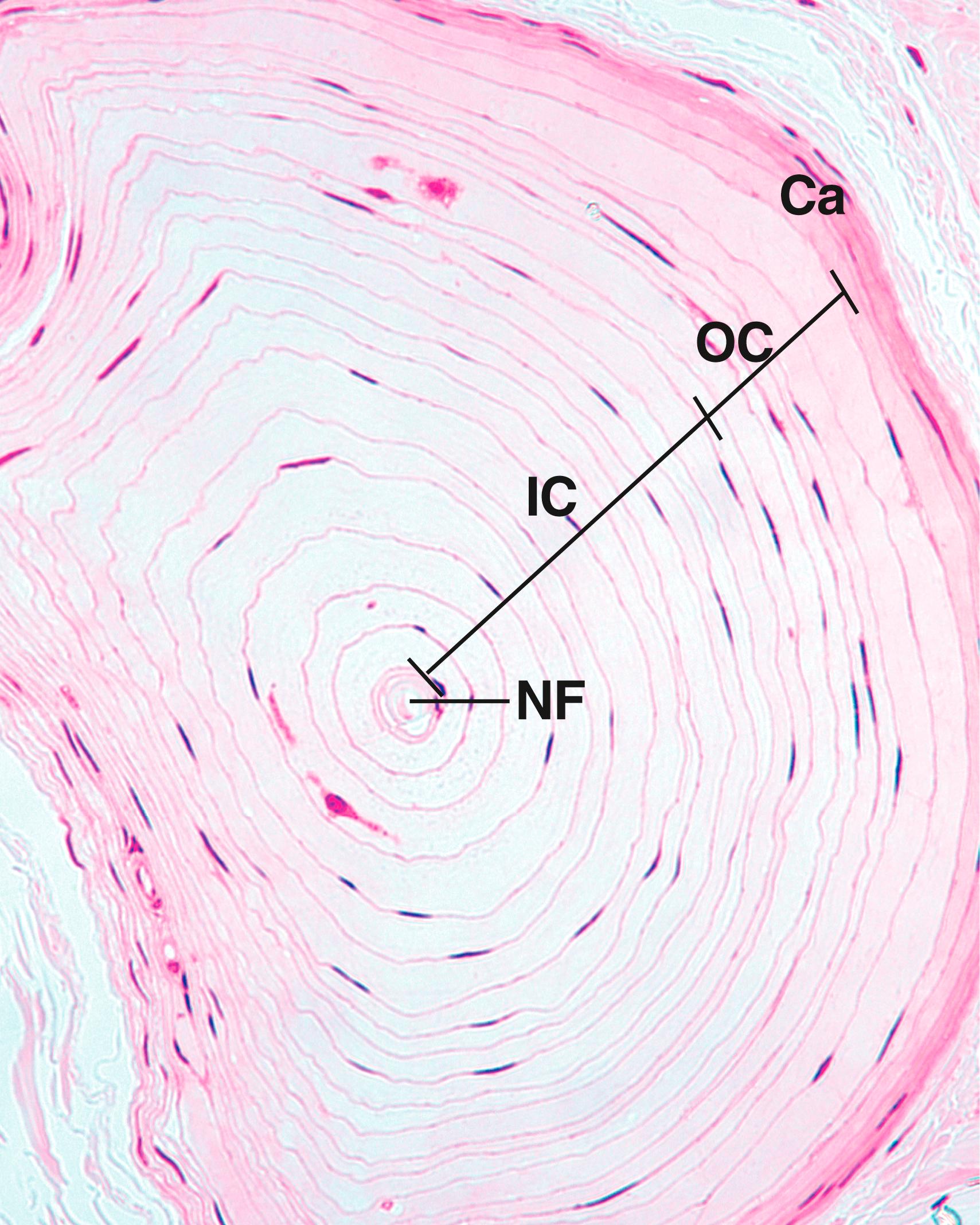 Fig. 22.3, Observe that this medium magnification of a cross-section of a small Pacinian corpuscle resembles an onion sliced in half. The nerve fiber (NF) has already lost its myelin sheath and is surrounded by several layers of fibroblast-like cells with fluid-filled spaces between the layers that form the inner core (IC). The outer core (OC) surrounds the inner core, which is, in turn, surrounded by a collagenous capsule (Ca). (×270)